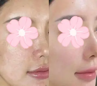 マツエク・マツパ aliaハイフ&水光ジェットサロン所属・aliaハーブ水光店 エステティシャン募集のエステ・リラクイメージ