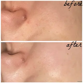 メンズ メナード岐阜市茜部 杉浦のエステ・リラクイメージ