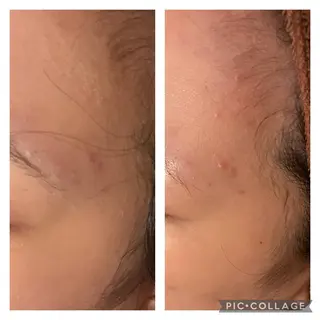 セミロング カラー パーマ ヘアアレンジ メンズ キッズ ネイル マツエク・マツパ アイブロウ ニキビ特化型エステ 🍓最短で肌質改善のエステ・リラクイメージ