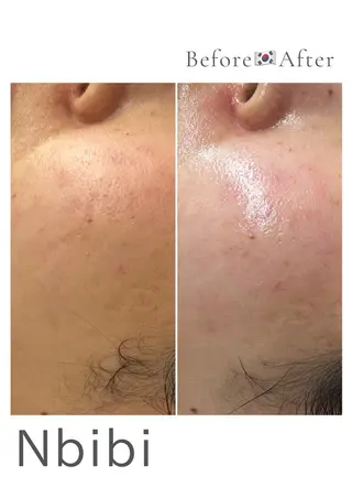 韓国🇰🇷価格 サロン_Nbibiのエステ・リラクイメージ