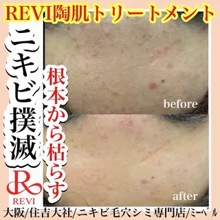 salon  mebell所属・肌管理専門店 mebell天王寺店のエステ・リラクイメージ