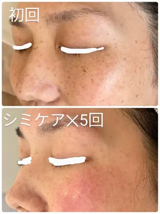 babyaiai所属・babyaiai 　momo🍑のエステ・リラクイメージ