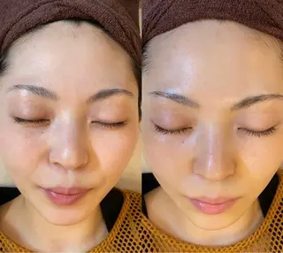 ハーブピーリング🌿 脱毛🧡ヘッドスパのエステ・リラクイメージ