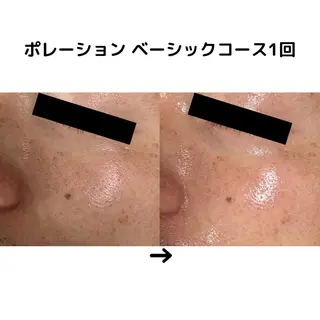 ミューズエステ 谷口美結のエステ・リラクイメージ