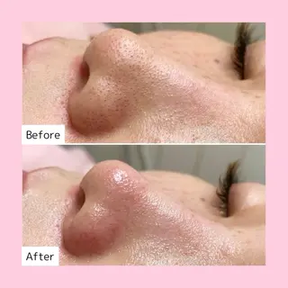 韓国肌管理専門店　White labo 新潟店所属・韓国肌管理専門店 Rihoのエステ・リラクイメージ