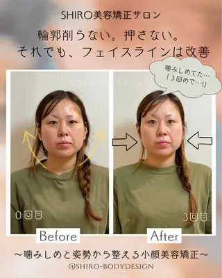 小顔美容矯正勝山式 shiroしろのエステ・リラクイメージ