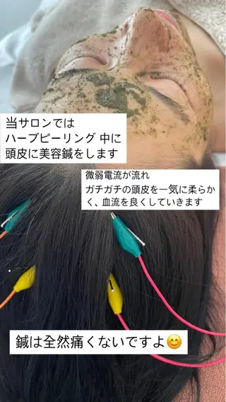 美容鍼サロン    Fleurir所属・伊藤 かなえのエステ・リラクイメージ