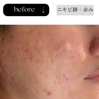 ICHOOSE/ 代々木上原のエステ・リラクイメージ