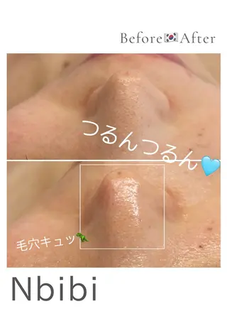 韓国🇰🇷価格 サロン_Nbibiのエステ・リラクイメージ