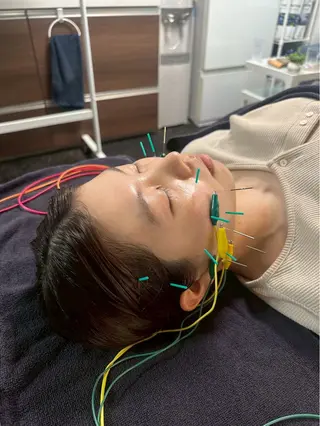 美容鍼・小顔矯正 FLOW 鍼灸整体院のその他イメージ