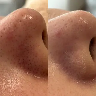 mili mili beauty salon所属・mili mili 岡本のエステ・リラクイメージ