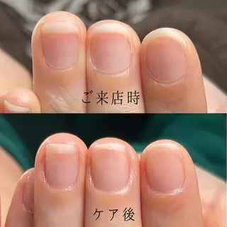 ネイル Aim* 深爪・自爪育成専門店のネイルデザイン