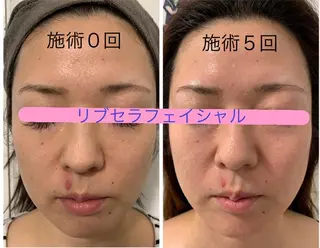 Private Salon Prunelle所属・プライベートサロン プリュネルのエステ・リラクイメージ