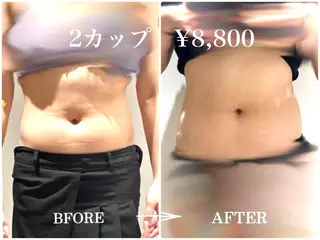 脂肪冷却痩身サロン SHIFT 東京のエステ・リラクイメージ