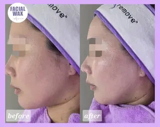 facial salon Lily所属・salon Lilyのエステ・リラクイメージ