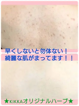 ハーブピーリング 専門店Kikkaのエステ・リラクイメージ