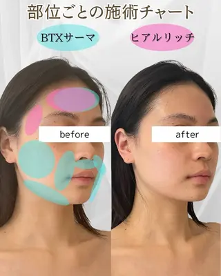 小顔/たるみ/黒ずみ除去専門サロン/SONA 大和西大寺店所属・【小顔専門看護師 サロンSONA】のエステ・リラクイメージ