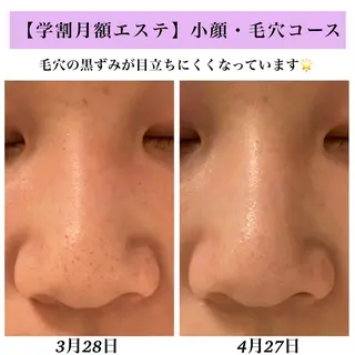 Bellesthe （ベルエステ）のエステ・リラクイメージ