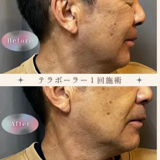 epi &... TOTAL BEAUTY所属・epi &... Harukaのエステ・リラクイメージ