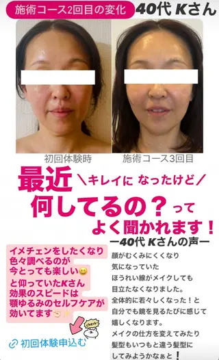 la lumie're (ラ リュミエール)所属・小顔サロン (ラ リュミエール)のエステ・リラクイメージ