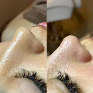 セルフエステエンリケ明石大久保店所属・夕希 毛穴と脱毛特化サロンのエステ・リラクイメージ