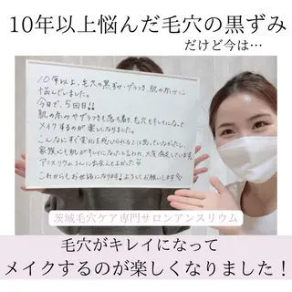 毛穴ケア専門サロンアンスリウム所属・茨城土浦 つくば毛穴 ケア専門サロンのエステ・リラクイメージ