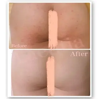 レティティア【Laetitia】所属・レティティア秋葉原店 Yoshizawaのエステ・リラクイメージ