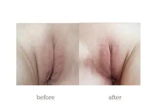 本気で痩せたい方へ 痩身専門サロンのエステ・リラクイメージ