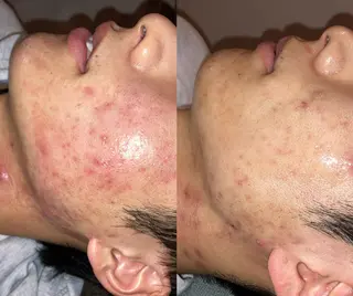 Mother TOKYOのエステ・リラクイメージ