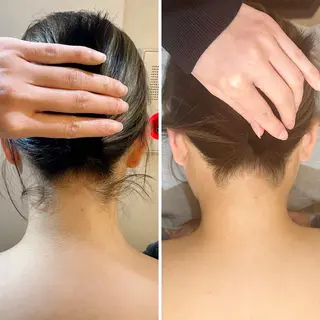 うなじ脱毛/美肌脱毛 LABELのエステ・リラクイメージ