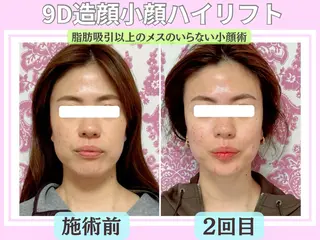 毛穴レス ハーブ＆ ワックス脱毛×光脱毛のエステ・リラクイメージ