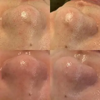 BELCIA福岡店　récolte de BELCIA（レコルトデベルシア）所属・BELCIA福岡店 レコルトデベルシアのエステ・リラクイメージ