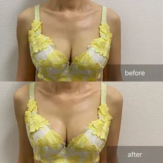 バストアップ専門店B leuBlanc田原のエステ・リラクイメージ