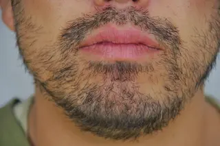 ビューティースタジオ DEWのエステ・リラクイメージ