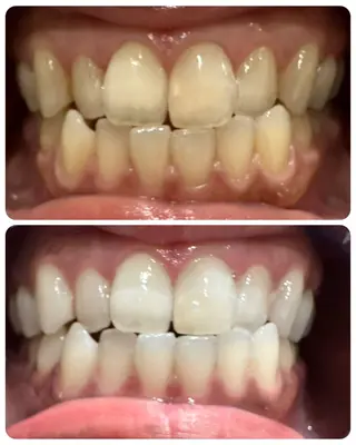 The Salon 脱毛&眉毛スタイリング&セルフホワイトニング所属・The Salon 脱毛&眉毛の眉毛・アイブロウイメージ