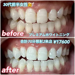 ホワイトニングビューティー西宮店所属・ホワイトニングビュー ティー西宮店のその他イメージ