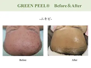 ULT ultimateskin所属・ULT ウルトのエステ・リラクイメージ