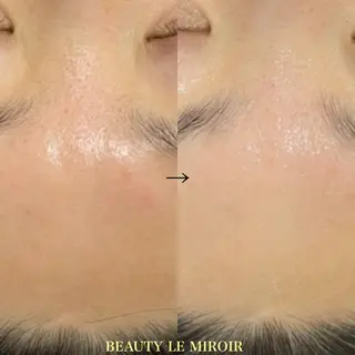 マツエク・マツパ ビューティー ミロワールのエステ・リラクイメージ