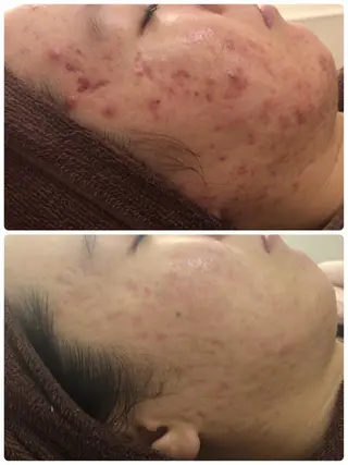 ミディアム カラー パーマ ヘアアレンジ メンズ キッズ ネイル マツエク・マツパ ニキビ・肌質改善専門 ♡人生が変わるサロンのエステ・リラクイメージ