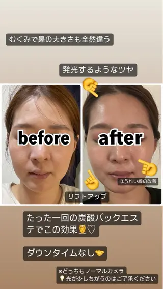 Liberte リベルテ(トモ化粧品店内)所属・RINA 🍒のマツエク・マツパデザイン