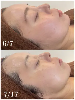 パーソナル肌質改善 🦋APRI🅿️有のエステ・リラクイメージ