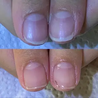 ネイル 自爪育成/深爪矯正 mikiのネイルデザイン