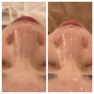 ANERA Second所属・尾上 沙織のエステ・リラクイメージ