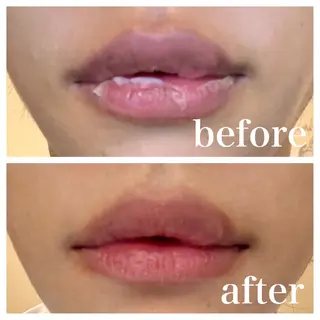 医療提携サロン新宿 La Lunaのエステ・リラクイメージ