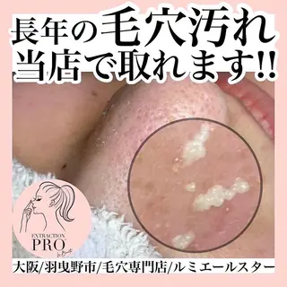 シミケア放題専門 /杉原いくえのエステ・リラクイメージ