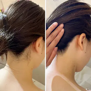 うなじ脱毛/美肌脱毛 LABELのエステ・リラクイメージ