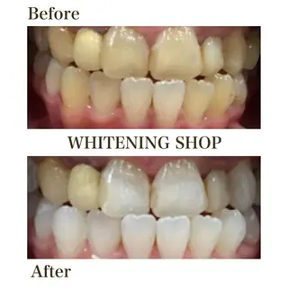 ホワイトニングショップ津店所属・ホワイトニング ショップ津店のその他イメージ