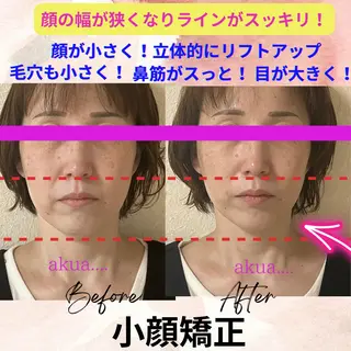 akua... 【肌質管理専門】のその他イメージ