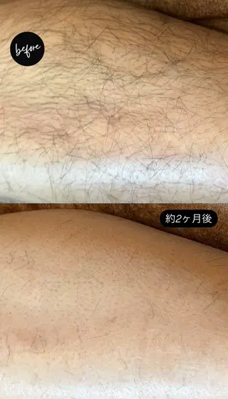 Hit. シュガーリング豊橋のエステ・リラクイメージ