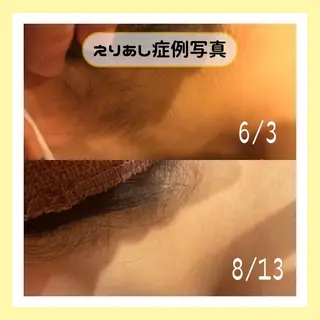 金山/脱毛/美肌 ULULUのエステ・リラクイメージ